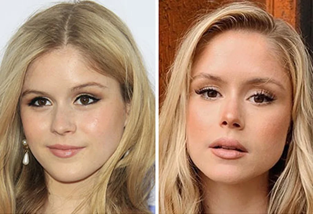Erin Moriarty Before and After: Stunning Transformation
