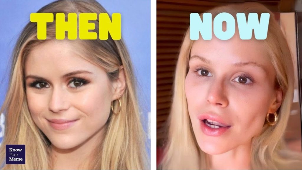 Starlight Before And After See the Stunning Change!(00)